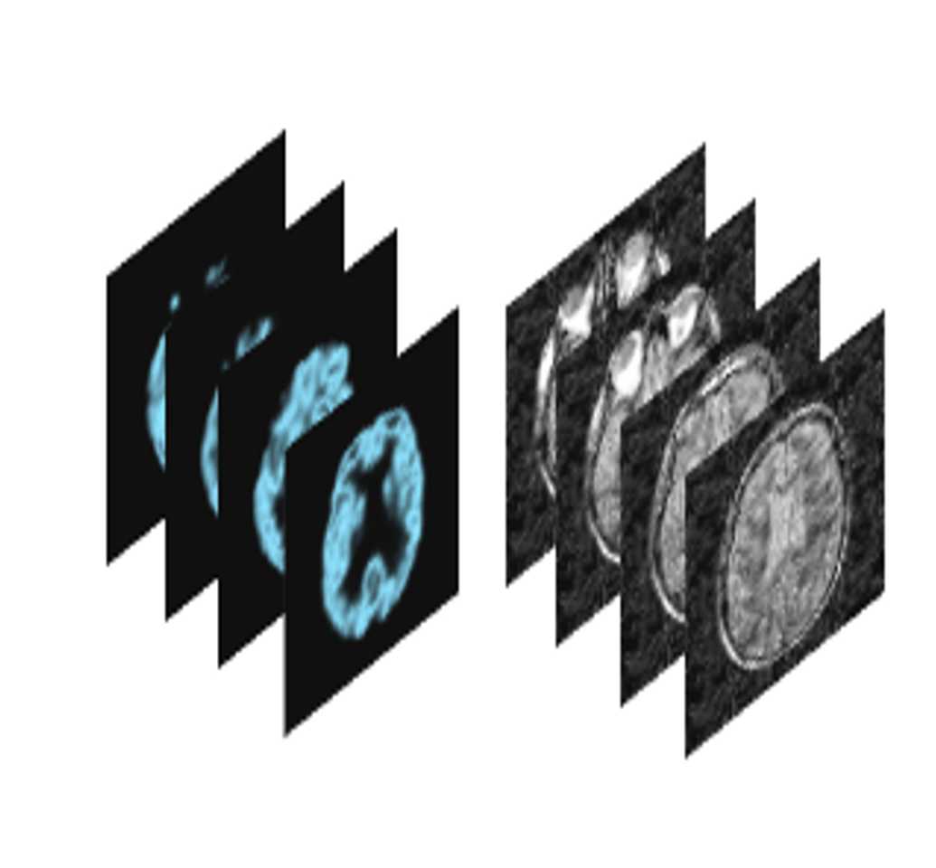 Evidence Combination